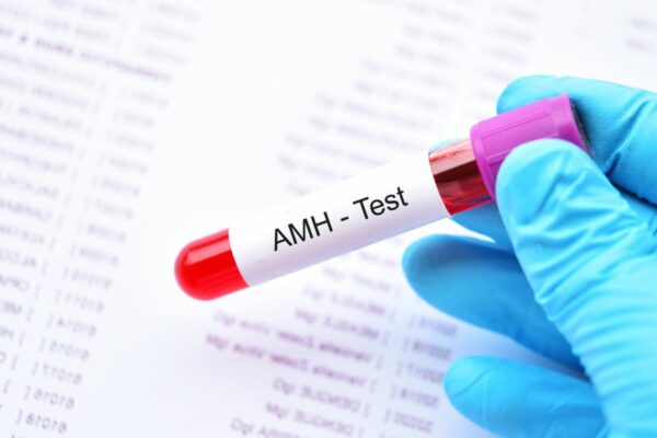 Hormona Antimülleriana (HAM o AMH)